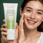 Acne Vage Cream - Image 2